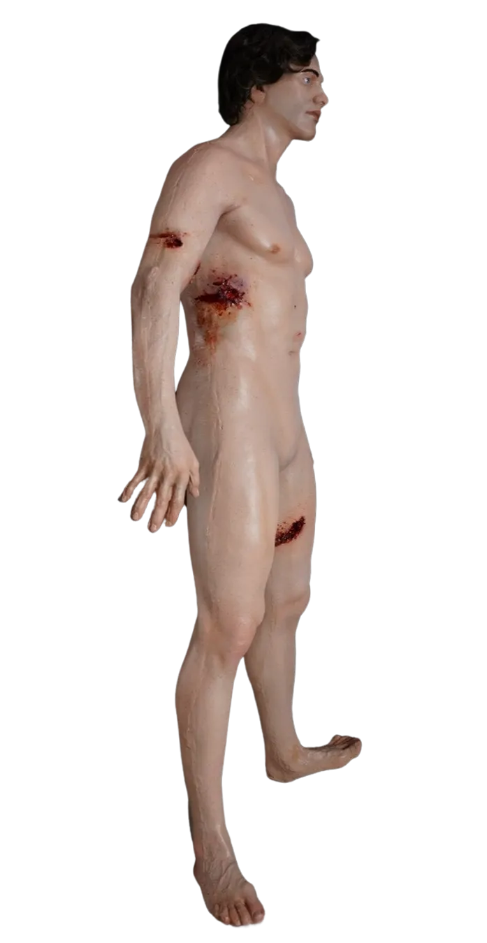 Dura Gunshot Trauma David Body