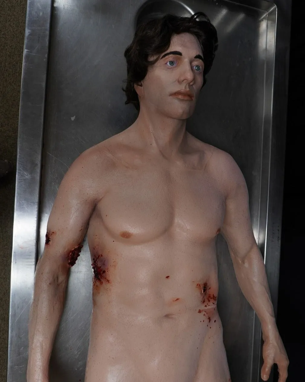 Dura Gunshot Trauma David Body