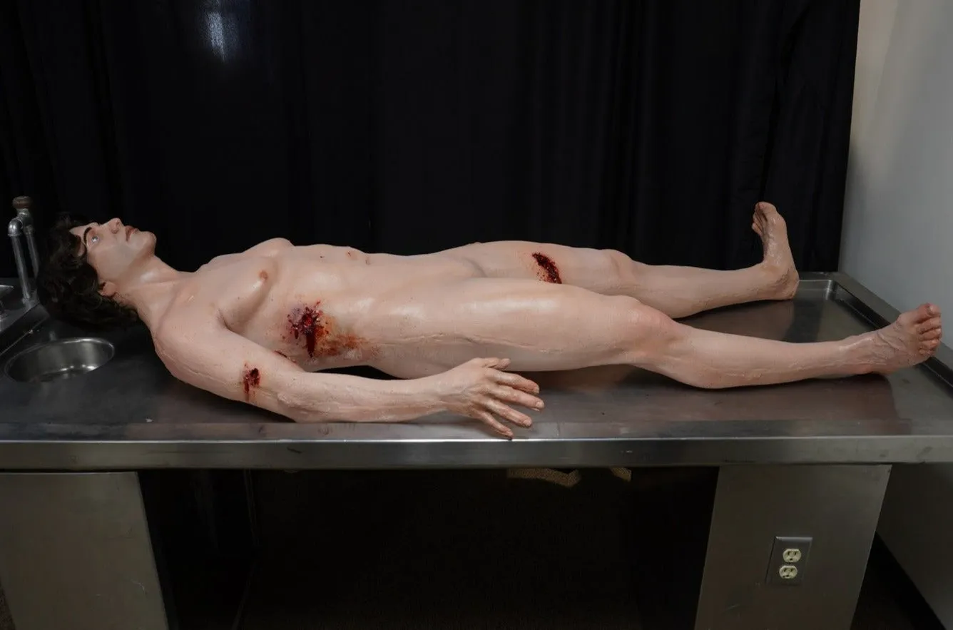 Dura Gunshot Trauma David Body