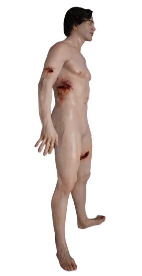 Dura Gunshot Trauma David Body